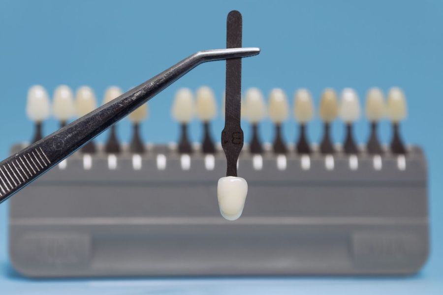 Digitale Planung & Farbbestimmung - So läuft die Behandlung deines Zahnersatzes bei Dr. Petry & Tuschen in Bad Soden ab